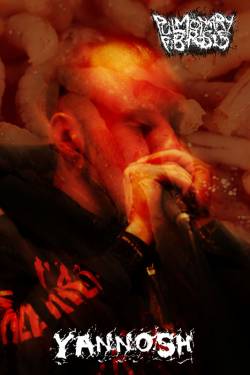 interview Pulmonary Fibrosis